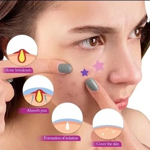 Adesivo Facial Estrela efeito Secativo para Acne
