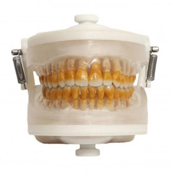 Manequim Top Periodontia I PD 102 - Pronew