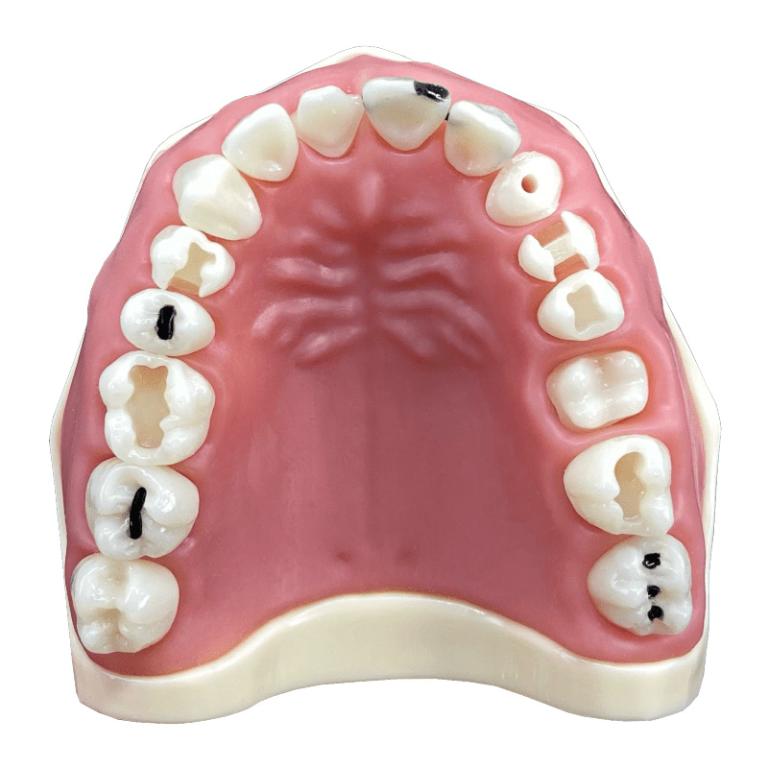 Manequim Materiais Dentários - Cod.217N - Orais