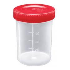 COLETOR URINA 80ML 3B UNIVERSAL C/100