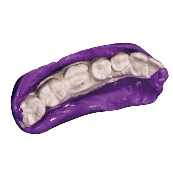 SILICONE DE ADIÇÃO SCAN DIE YLLER